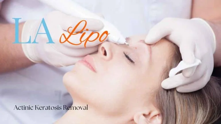 Woman receiving Actinic Keratosis Removal Treatment Eastcote