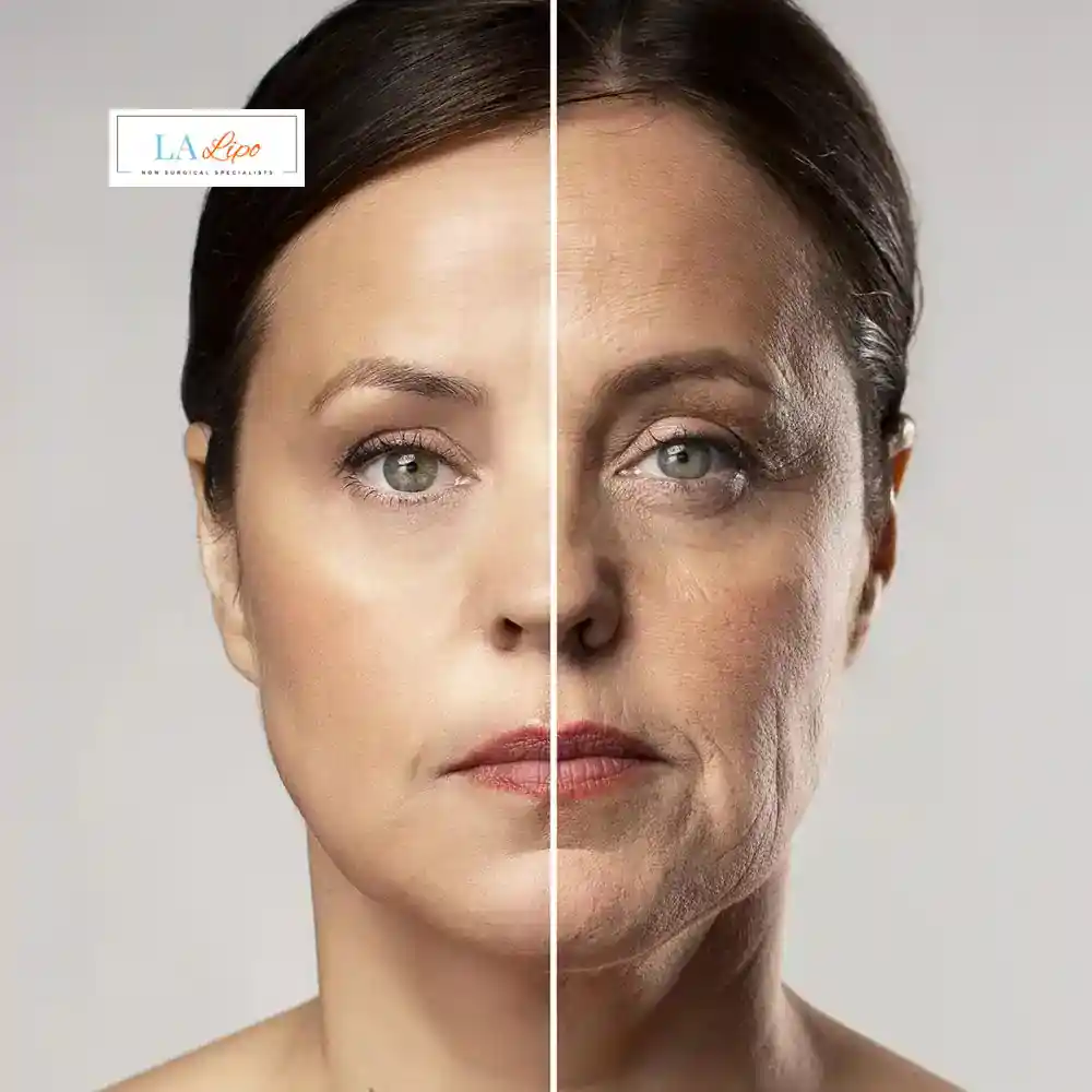 How Can You Tell If Non-Surgical Skin Tightening Is Right for You Eastcote?