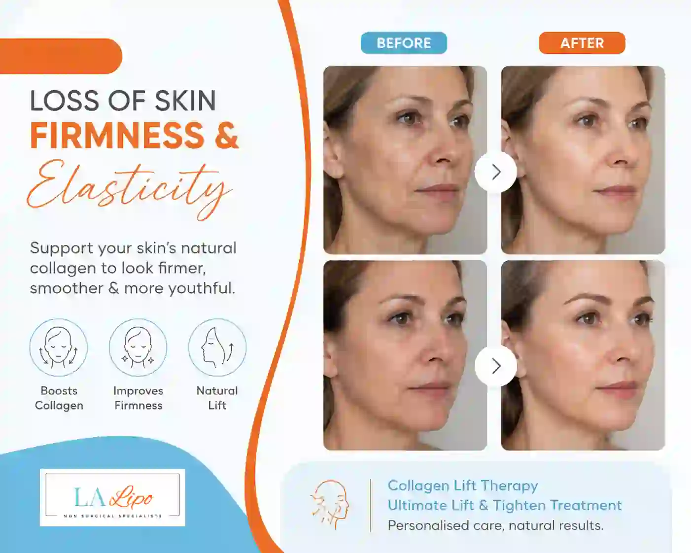 Sign #7: Loss of Skin Firmness and Elasticity Eastcote